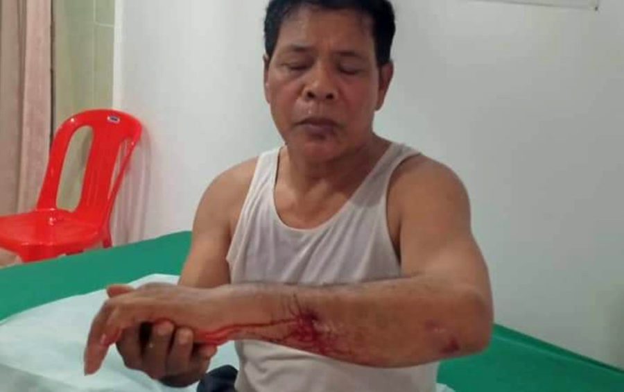 Former CNRP commune chief Sin Bona at a private clinic in Phnom Penh after being attacked by two unidentified men on September 25, 2019 (CNRP activist’s Facebook page)