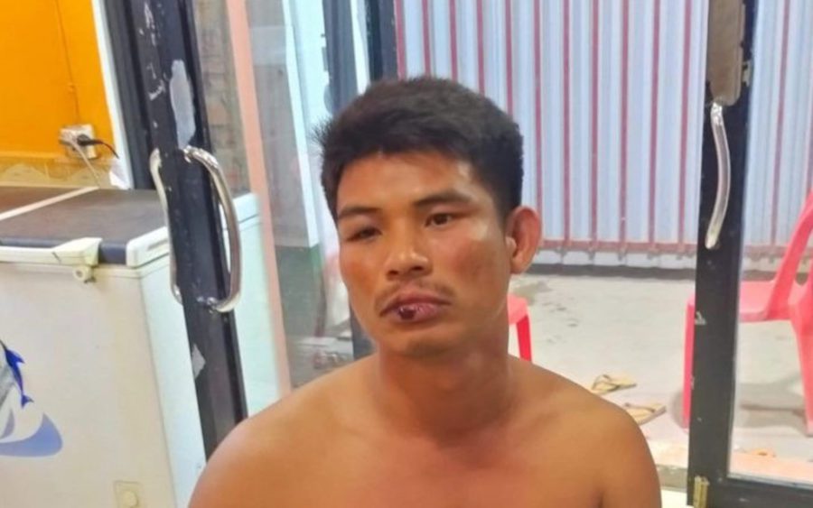 Tim Chamrong, 37, after he was beaten by police officers in Prey Nob district’s Bit Traing commune in Preah Sihanouk province, in a photo supplied by his brother, Tim Chamroeun.