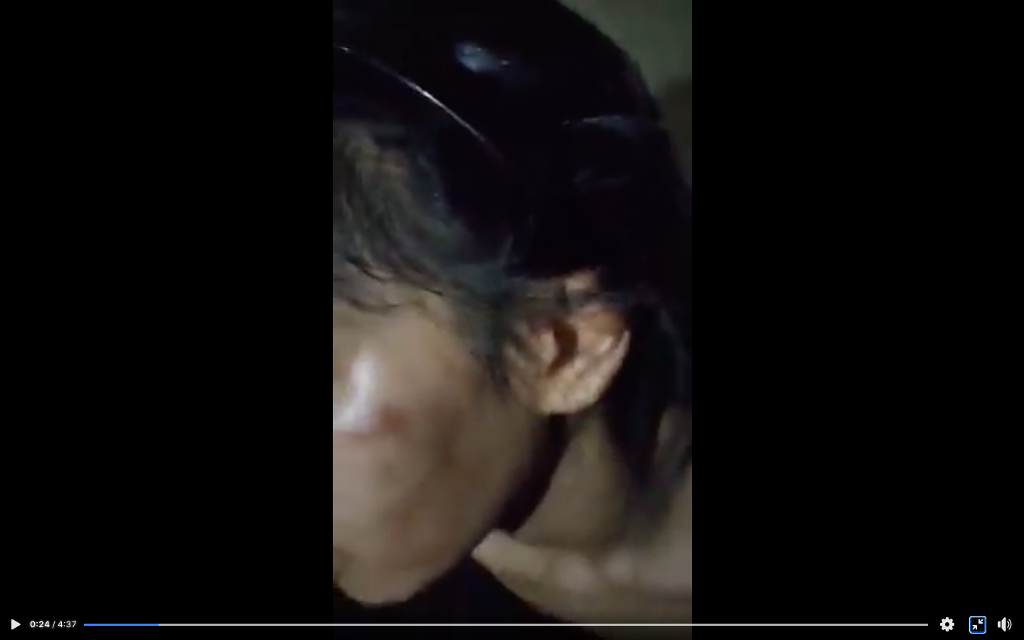 A 16-year-old Cambodian’s injuries following alleged abuse in Malaysia, in a screenshot of a video posted to Facebook.