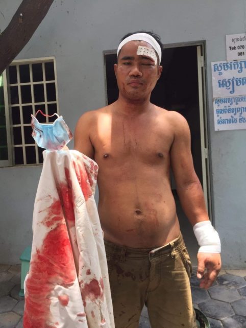 Sin Khon, a former CNRP youth activist, shows his bloody shirt after being attacked by four men on May 12, 2021. (Supplied)